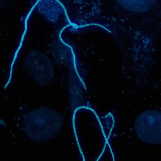 9bc66c2abb8e98aca